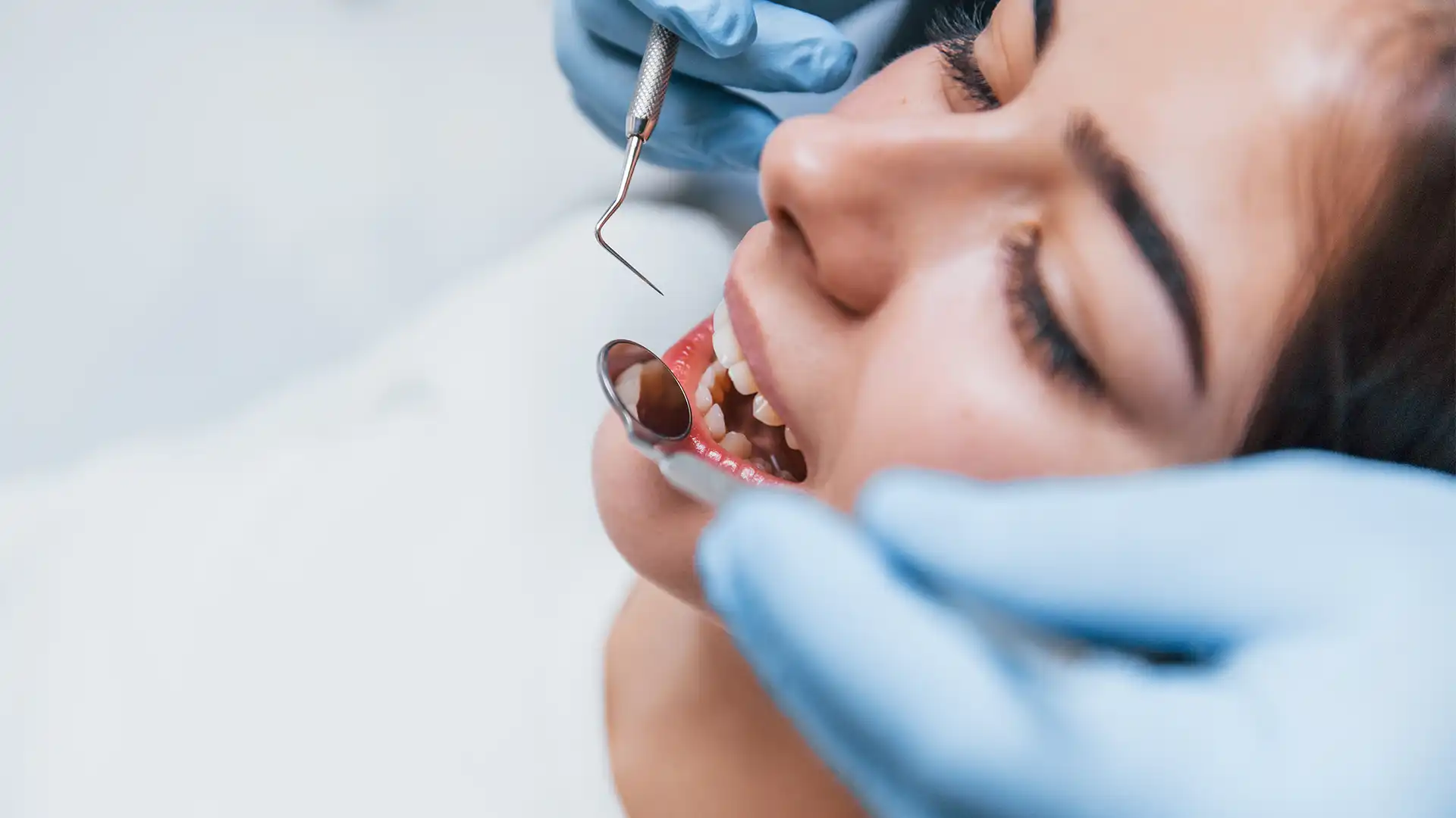 Пакет «Голлівудська посмішка» в Туреччині